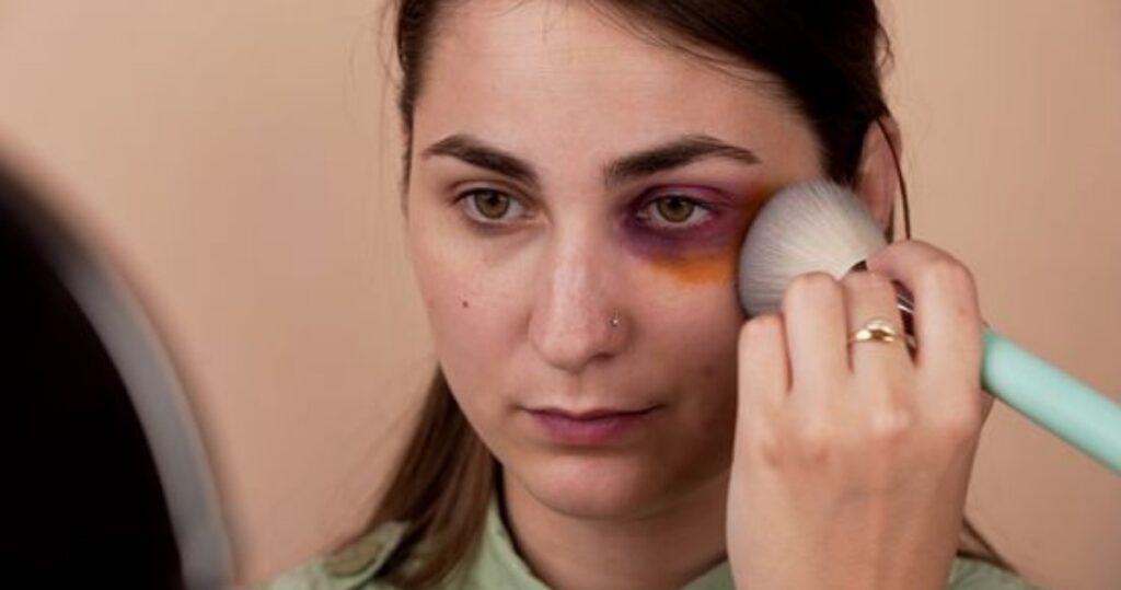 How To Cover Up A Bruise With Without Makeup Ulike