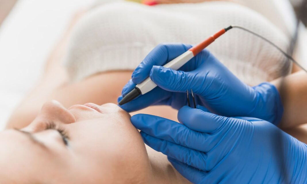 How Much Electrolysis Hair Removal Cost