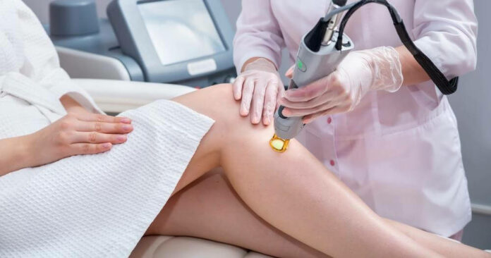 8 Laser Hair Removal Side Effects and Risks, You Should Know!