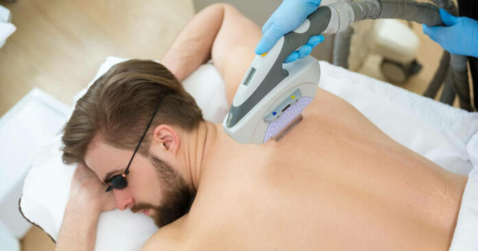 7 Amazing Benefits of Hair Removal for Men