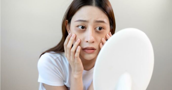 How to Get Rid of Under-Eye Bags Fast? (Professional Guide)