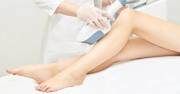 How to Treat Burns from Laser Hair Removal? (& Avoid Ways)