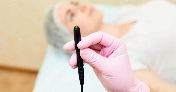 Waxing vs. Electrolysis: Which Hair Removal is Better?