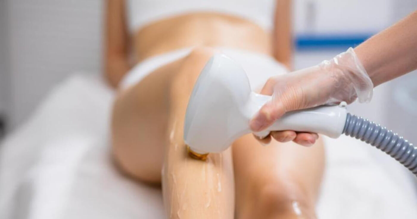 Laser Hair Removal Guide Everything You Need to Kown