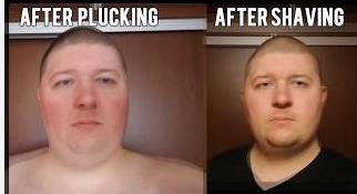 Plucking Vs Shaving Chin Hair
