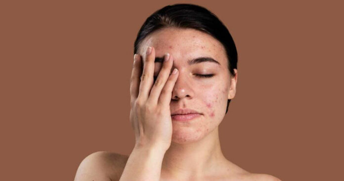 6 Best Face Wax for Sensitive Skin 2023