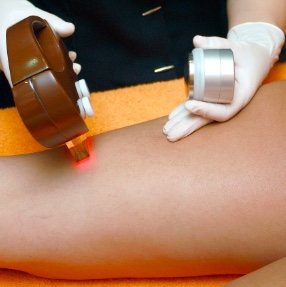 How Often Should I Get Laser Hair Removal Follow-Ups?