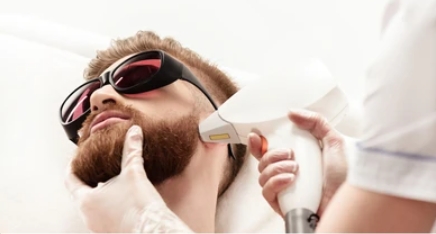 How to Use an IPL Device for Men’s Beards on the Face