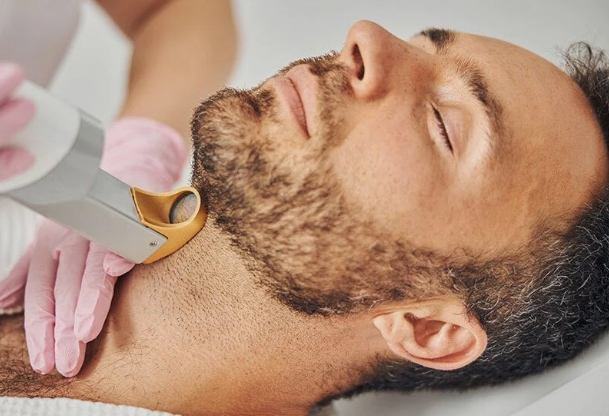 Is IPL Hair Removal Device Effective and Safe for Men’s Beard