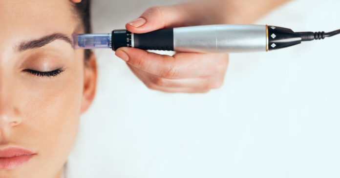 What is Micro-Needling? Its Benefits, Uses, and Results