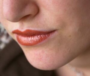 Disadvantages of Threading Upper Lip