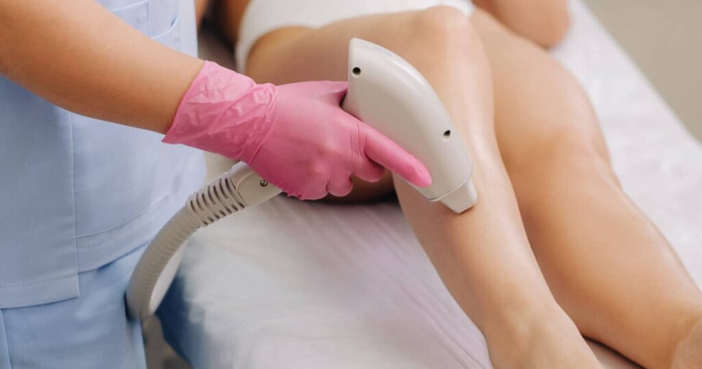 How Long Does Laser Hair Removal Last? (And FAQs) Ulike
