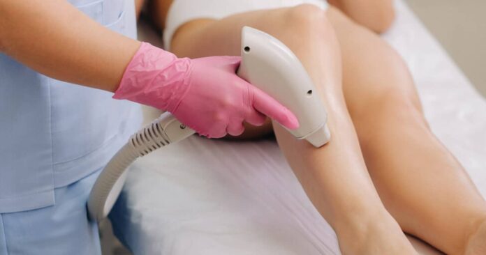 How Long Does Laser Hair Removal Last? (And FAQs)