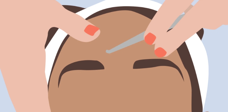 How to Do Dermaplaning at Home