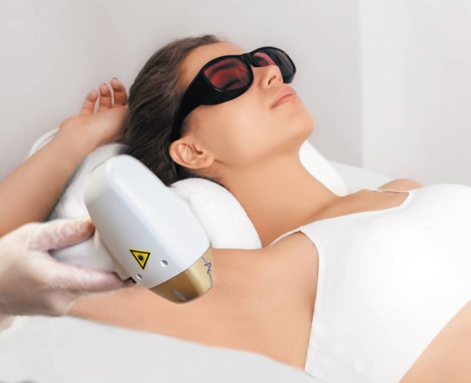 What is Laser Hair Removal