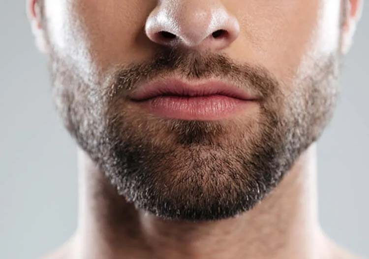 Is Laser Hair Removal Safe for Beard?