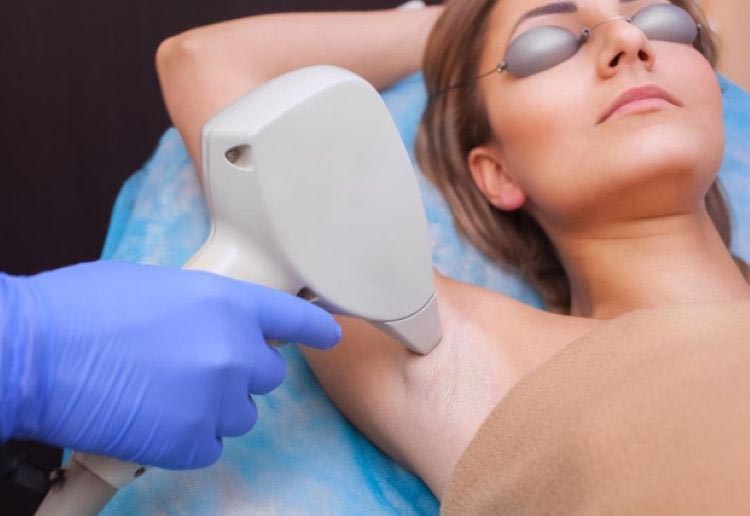 Laser Hair Removal for Young Adults