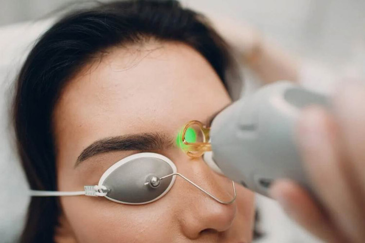 Laser Hair Removal Eyebrows Side Effects