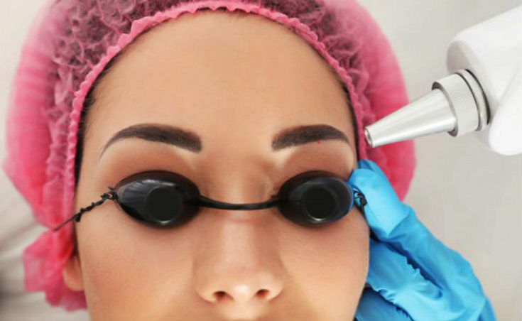 Preparing for Eyebrow Laser Hair Removal