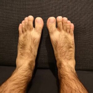 Causes of Hairy Feet