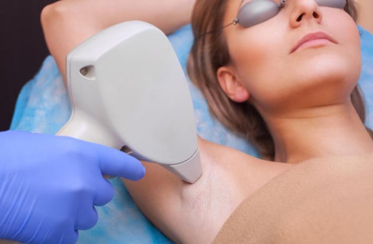 Do You Tip for Laser Hair Removal Treatments in the US