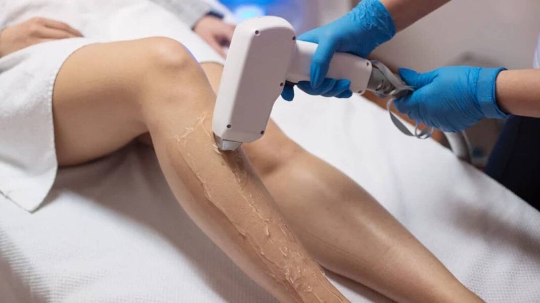 Laser Hair Removal and Scars