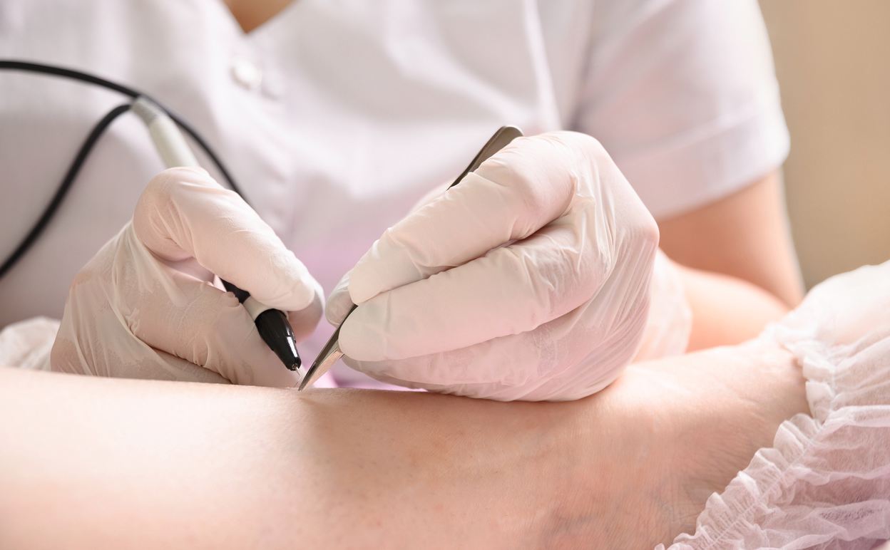 Can You Do Electrolysis at Home? Does Home Electrolysis Work? Ulike