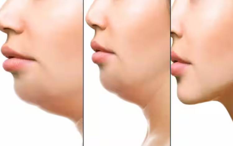 Facial Exercises to Target the Double Chin