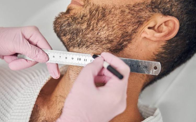 How to Tell if a Beard Neckline is Too Short or Too High