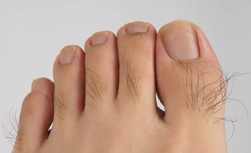Why Are My Toes Hairy?