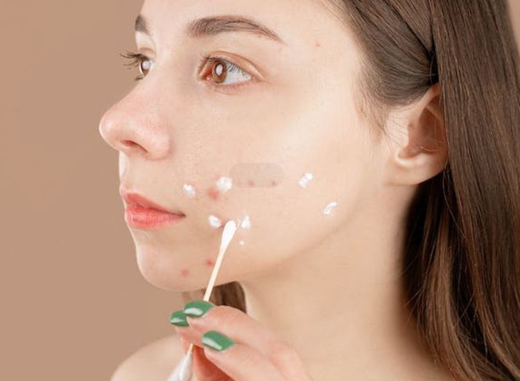 Additional Tips for Preventing Pimples After Shaving