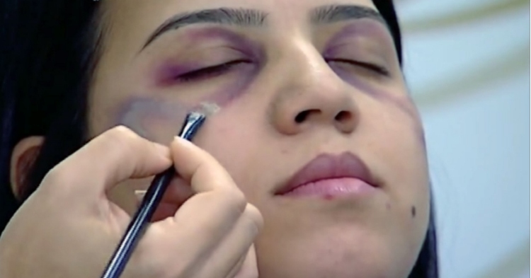 How to Cover up a Bruise with Makeup