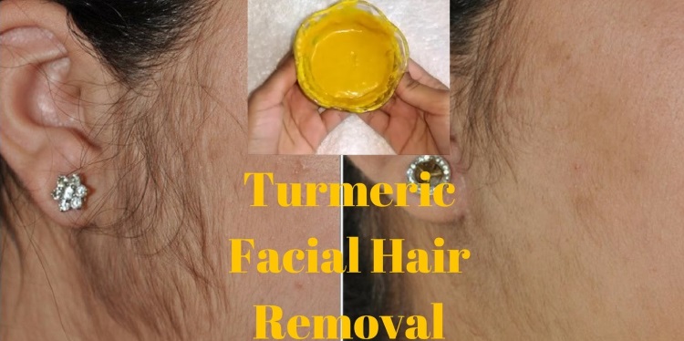 What are the Turmeric Hair Removal Before and After Results