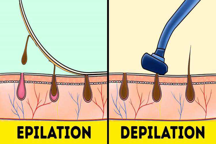 What is the Difference Between Depilation and Epilation