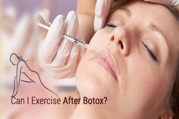 Can You Workout After Botox