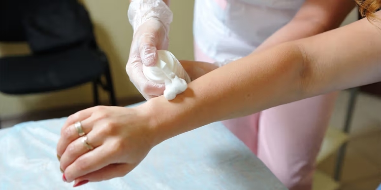 How to Prevent Chemical Burns Caused by Hair Removal Creams