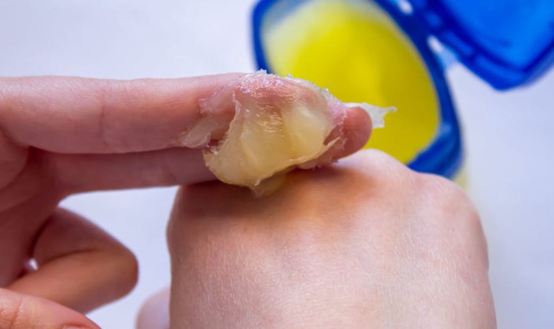 What Not to Do During Hair Removal with Vaseline