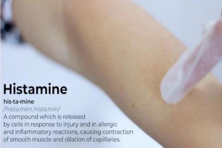 What is Histamine Reaction After Waxing
