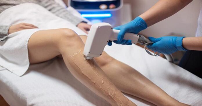 How Long Does Laser Hair Removal Take? What Can You Expect?