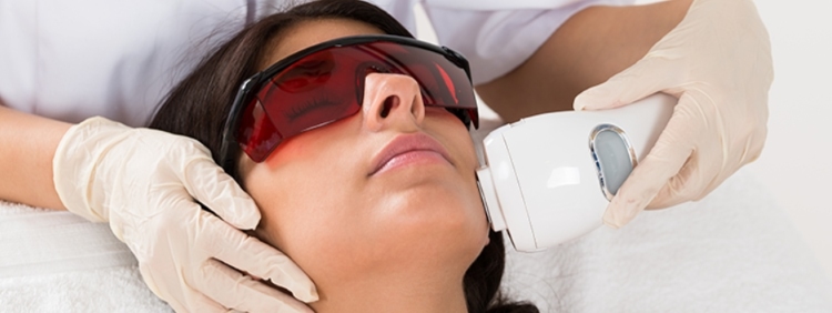 Three Key Factors Influencing the Duration of IPL Treatment Results