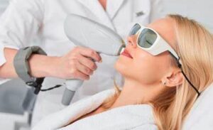 Facial Hair Removal Laser vs. Electrolysis
