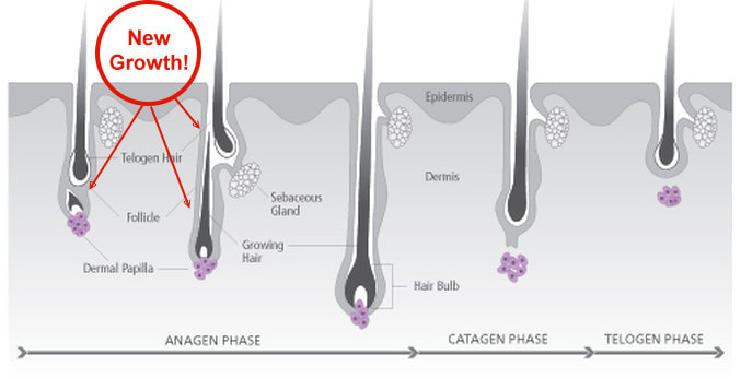 hair growth