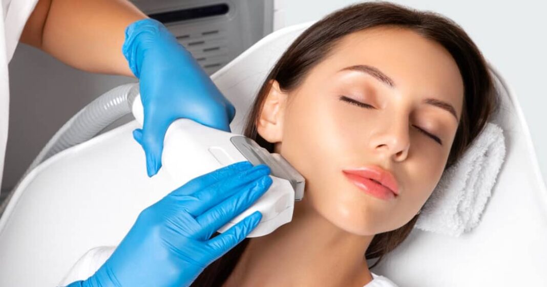 IPL for Acne: Does IPL Get Rid of Pimples?