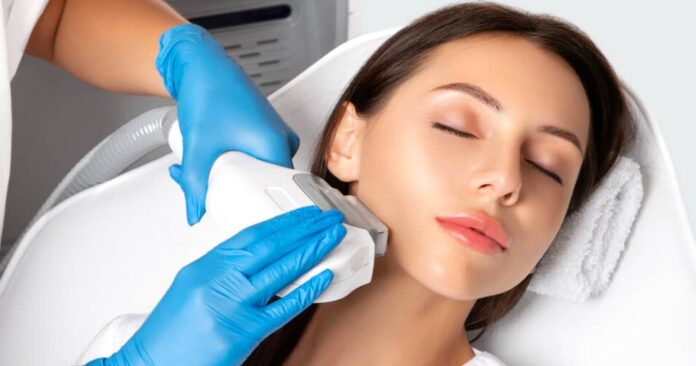 IPL for Acne: Does IPL Get Rid of Pimples?