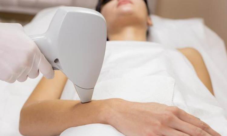 Is Laser Hair Removal Safe During Summer