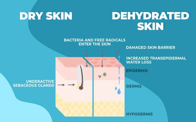 Dry vs Dehydrated Skin