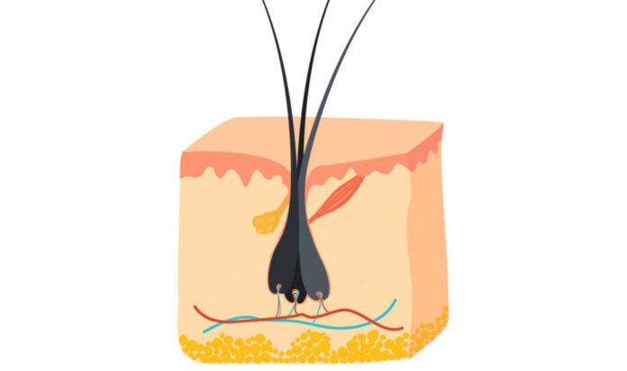 Why Are There Two Hairs in One Follicle: Causes, Removal Ways and FAQs