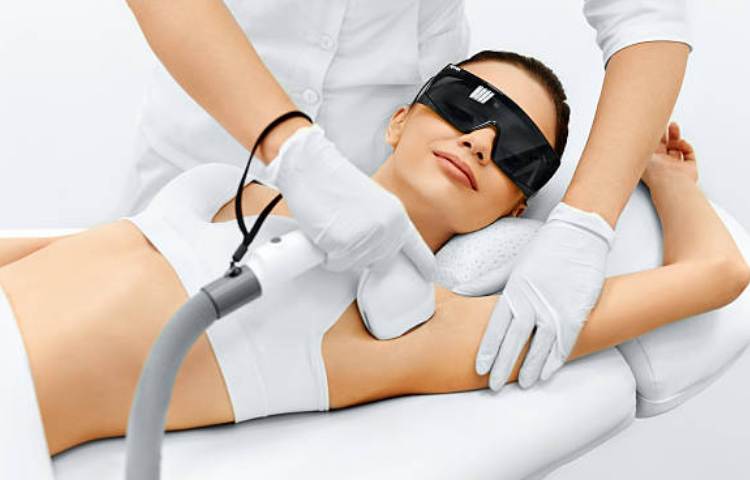 Laser Hair Removal