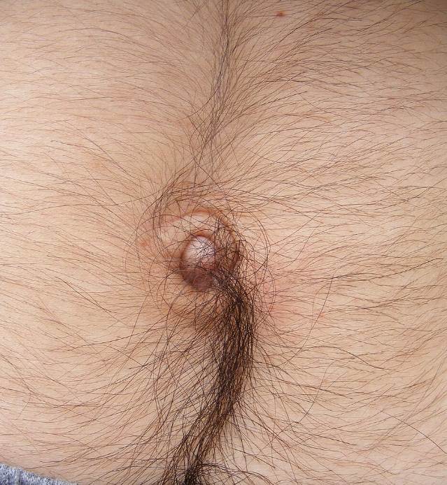 Hair On Stomach