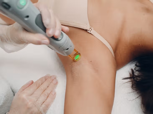 Hair Removal With Laser No Gel